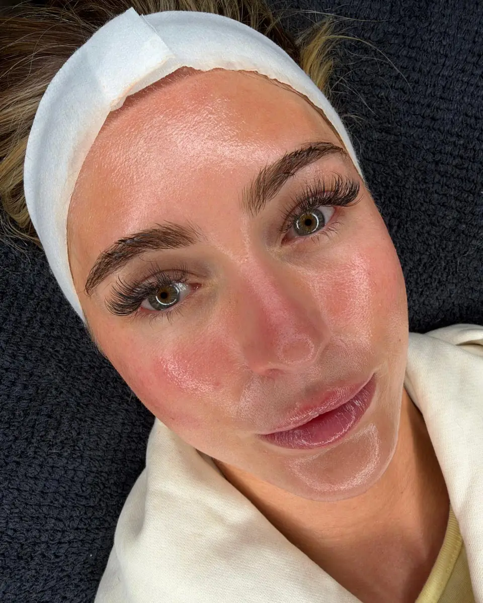 A client in a white headband and robe relaxing on the treatment couch after a professional peel at Glow By Yaz
